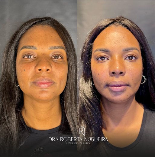 Cópia de 2-08 - cópia